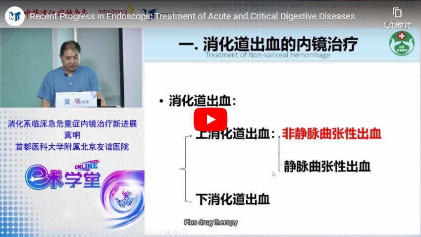 Recent Progress In Endoscopic Treatment Of Acute And Critical Digestive Diseases
